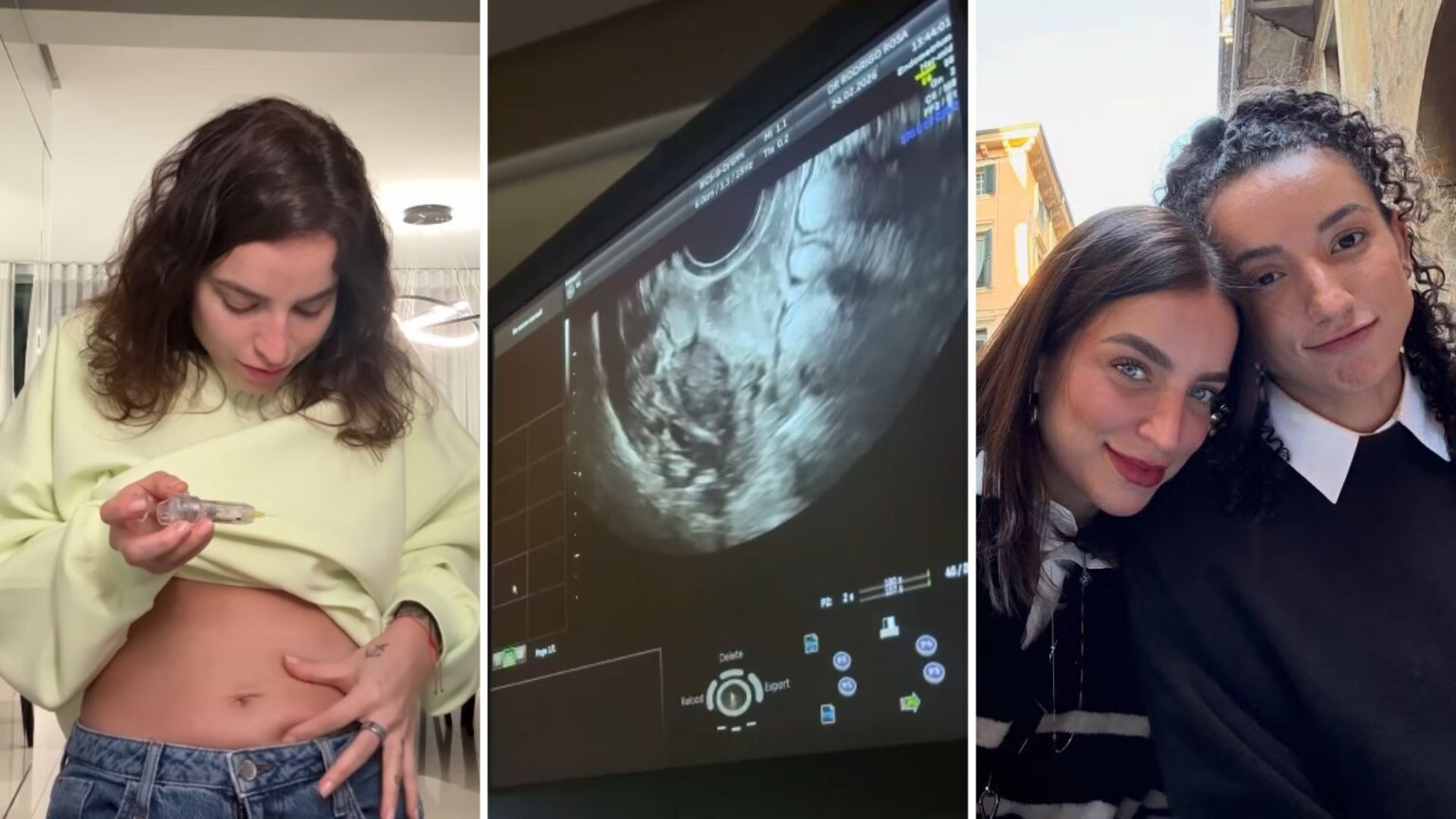 Boo Unzueta congela óvulos para sonho familiar com Gabi