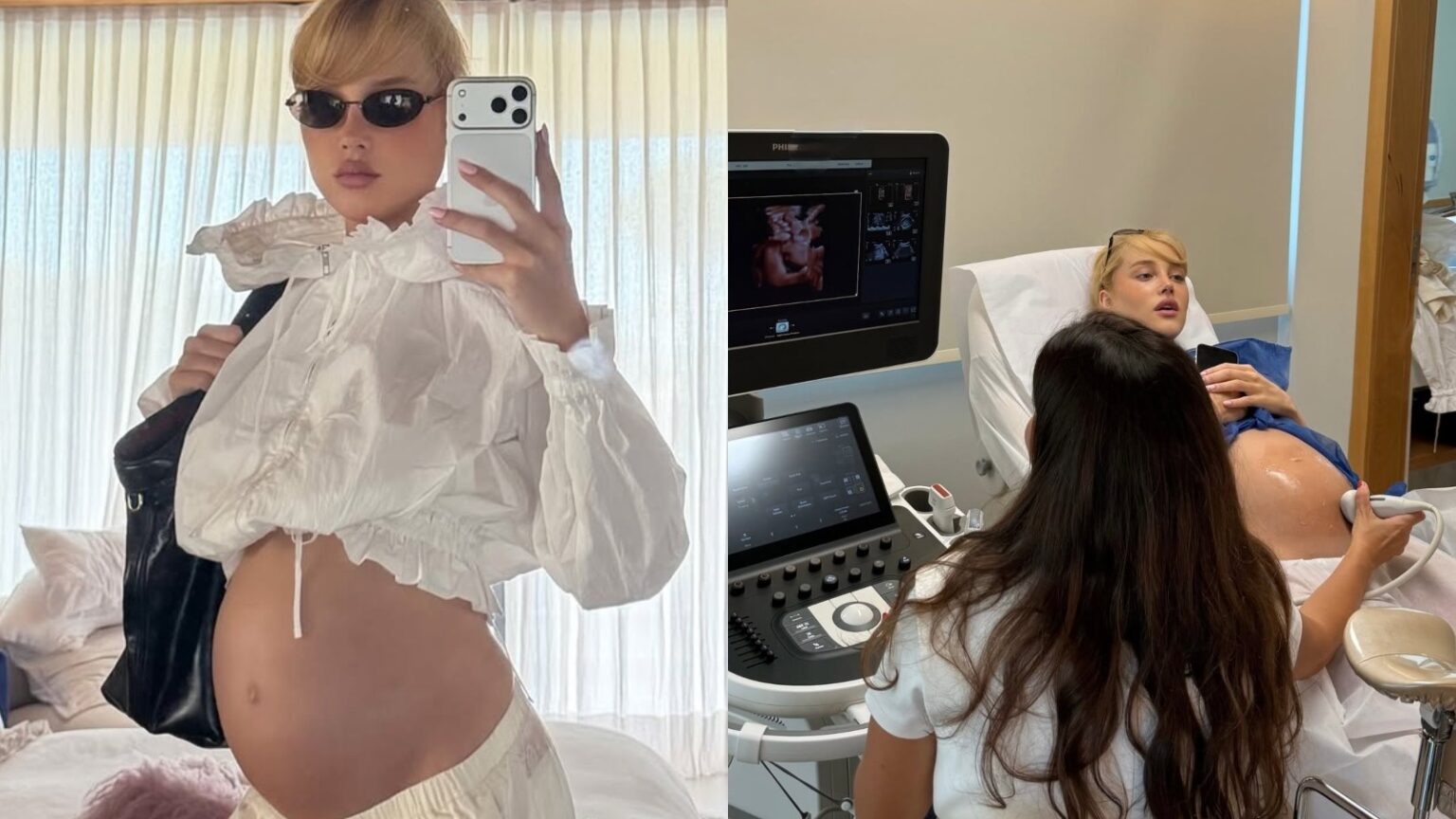 Malu Borges revela rosto da filha em ultrassom 3D Malu Borges revela rosto da filha em ultrassom 3D