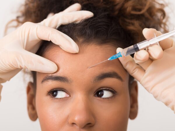 Botox preventivo em jovens: especialistas alertam para riscos