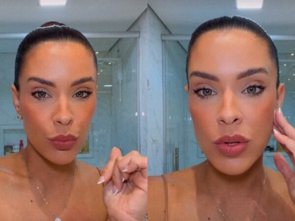 Ex-BBB Ivy Moraes revela diagnóstico de DTM e alerta sobre sinais do corpo