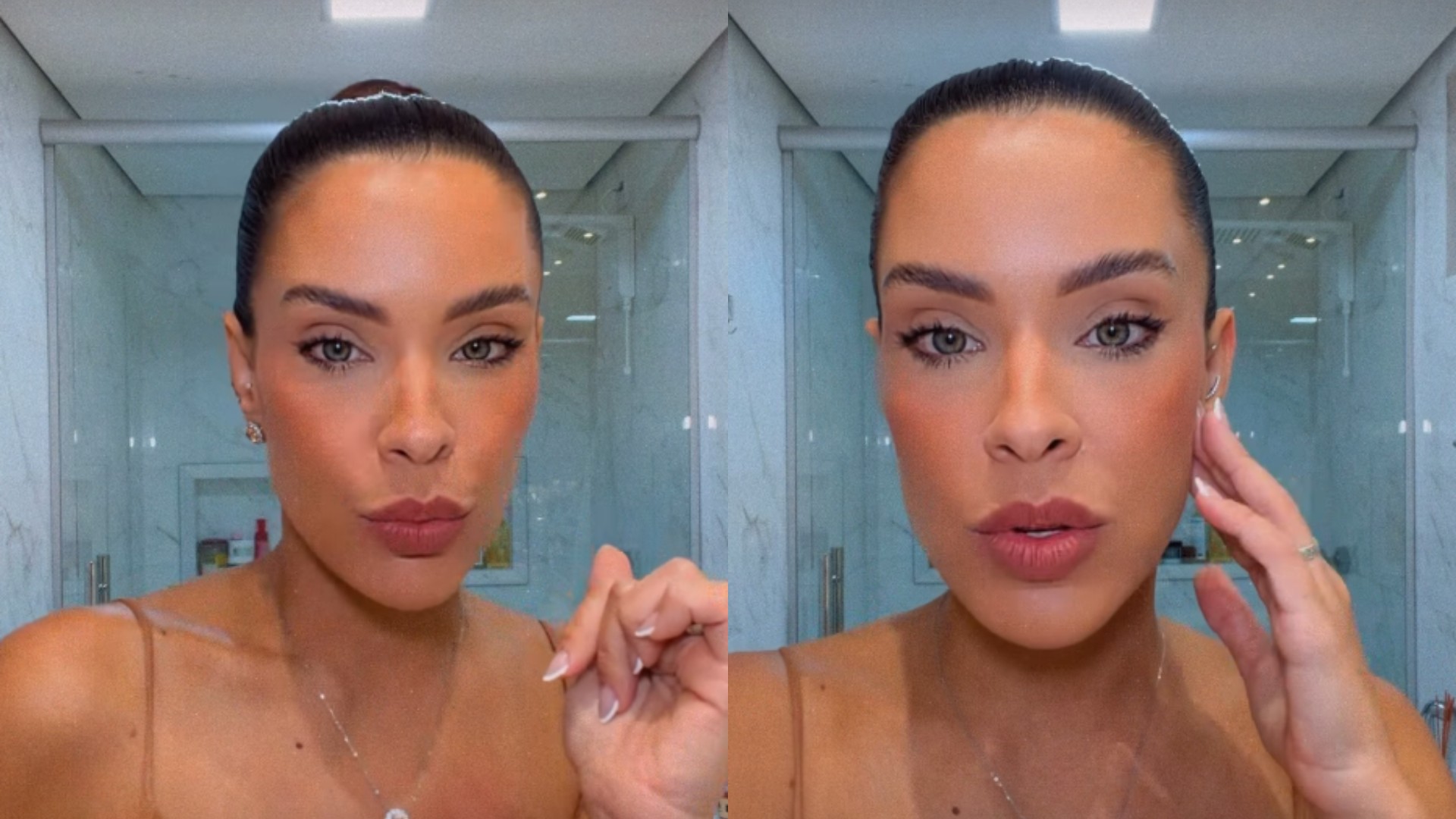 Ex-BBB Ivy Moraes revela diagnóstico de DTM e alerta sobre sinais do corpo