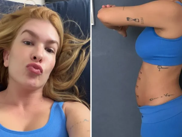 Lore Improta exibe diástase de 4 cm e normaliza pós-parto