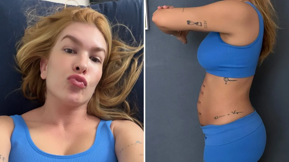 Lore Improta exibe diástase de 4 cm e normaliza pós-parto