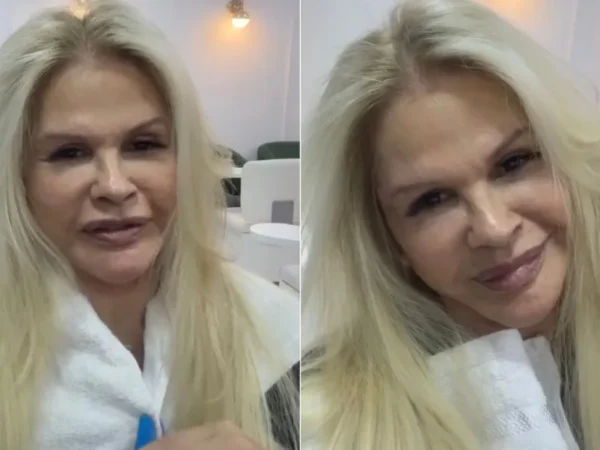 Monique Evans exibe rosto 8 dias após lifting: 'Me amando
