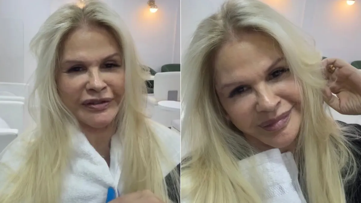 Monique Evans exibe rosto 8 dias após lifting: 'Me amando